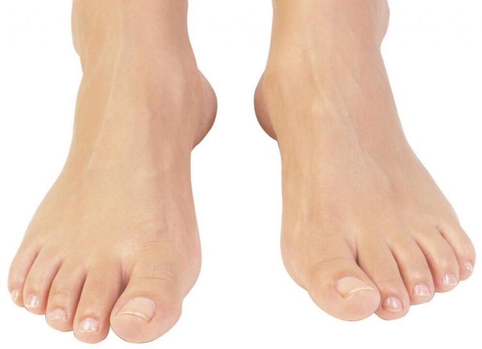 healthy toenails after fungal treatment