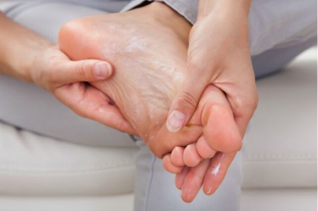 Antifungal creams and drops will help in the early stages of toenail fungus
