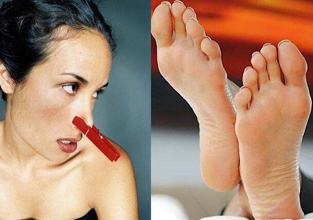 Unpleasant foot smell