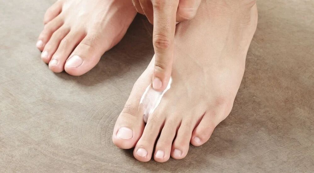 Apply cream from fungus between fingers