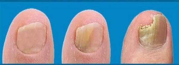 fungal development process