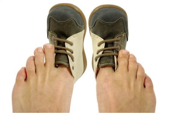 how to recognize toenail fungus with symptoms